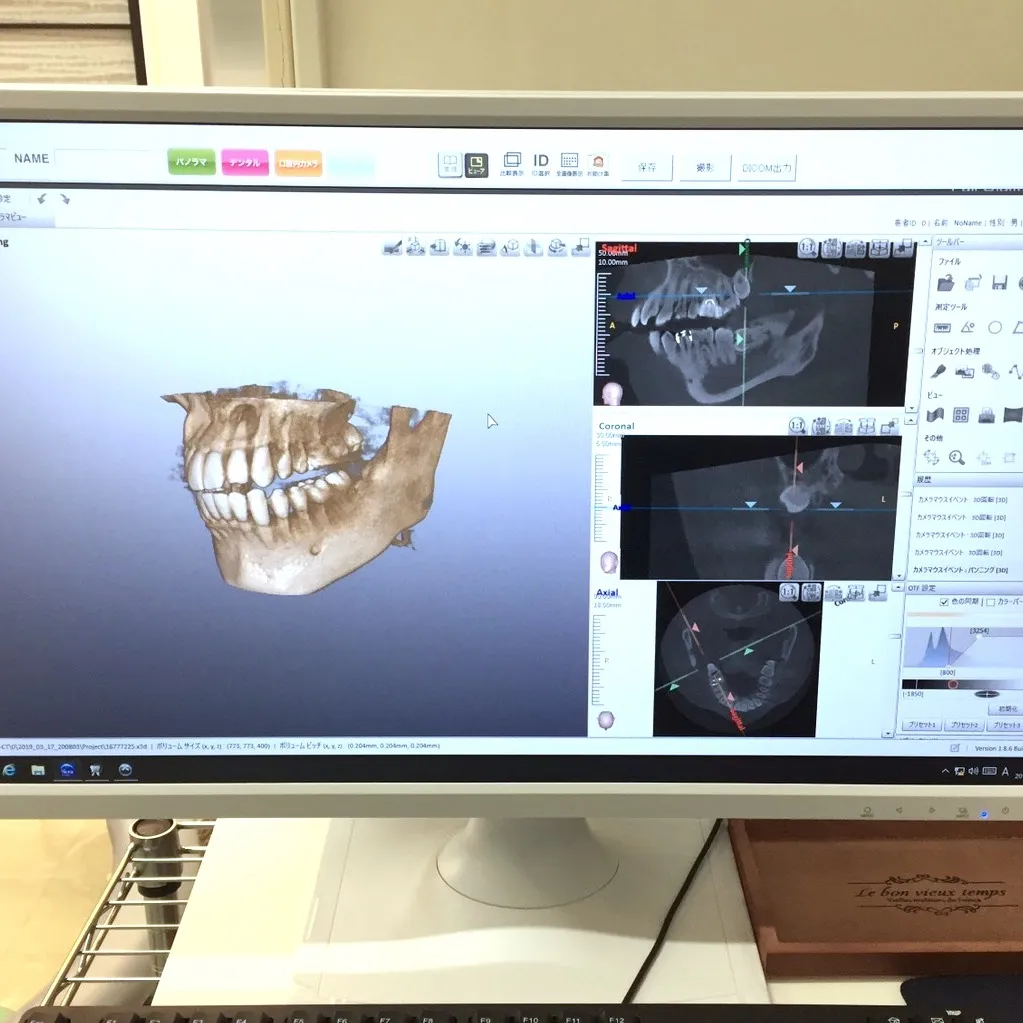 CT検査による精密診断